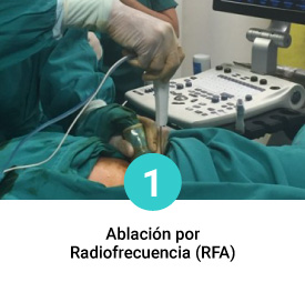 ablaciones-SERV07